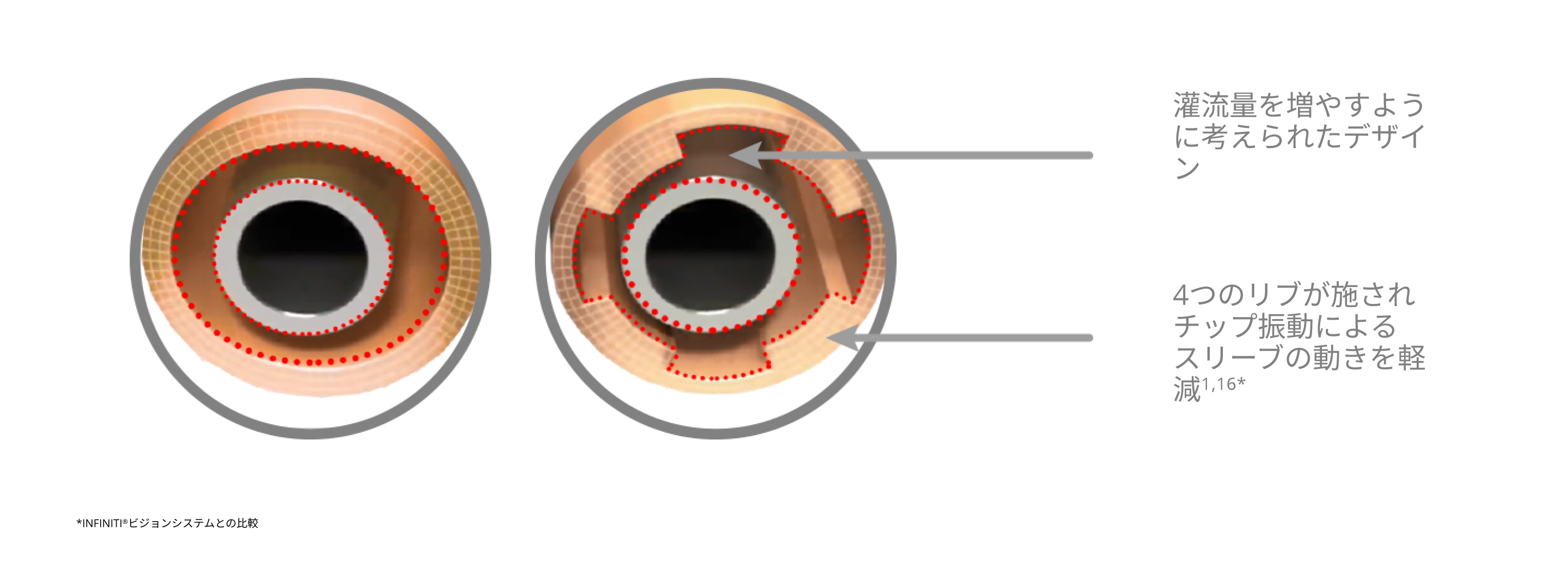 INFINITI Vision Systemと比較してスリーブの動きを抑え、灌流量を増加させる4リブスリーブデザインのINTREPIDスリーブを紹介するイメージ図
